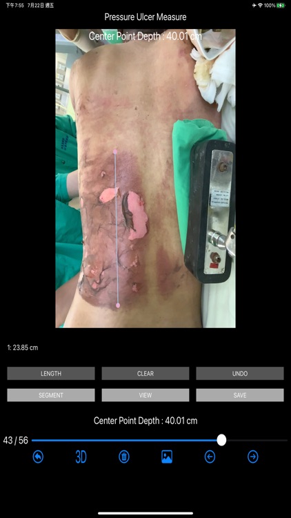 Burn Evaluation Network