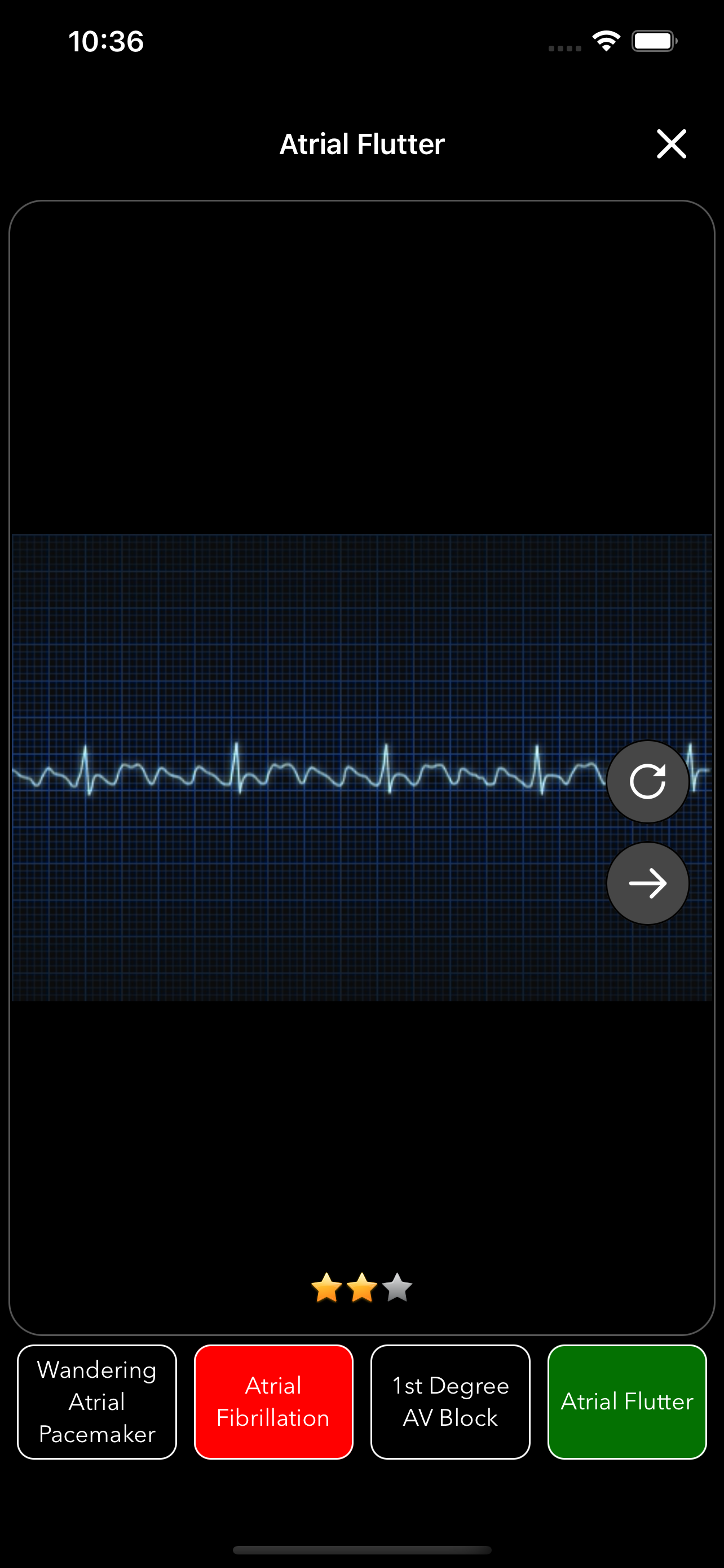 ECG Test for Doctors