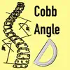 CobbAngleApp problems & troubleshooting and solutions