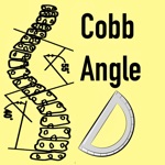 Download CobbAngleApp app
