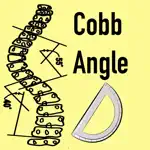 CobbAngleApp App Positive Reviews