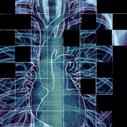 Chest X-ray Interpretation