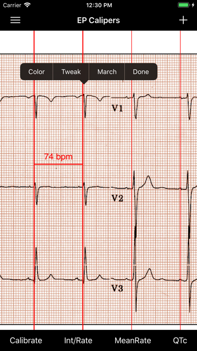 EP Calipers Screenshot