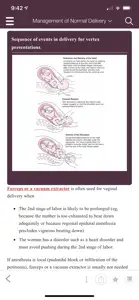 MSD Manual Guide to Obstetrics screenshot #2 for iPhone