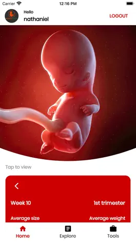 Game screenshot My Pregnancy Tracker mod apk