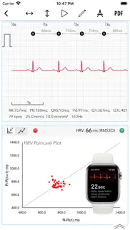 ecg+ | analyzer for qtc & hrv iphone screenshot 1