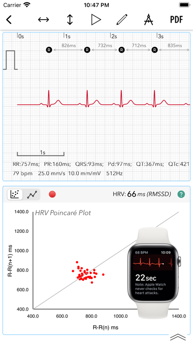 ECG+ | Analyzer for QTc & HRV Screenshot