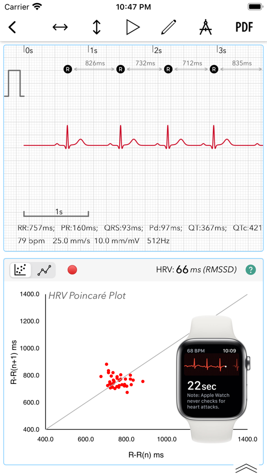 ECG+ | Analyzer for QTc & HRV - 1.8.1 - (iOS)