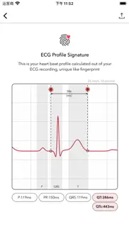 ecg+ | analyzer for qtc & hrv iphone screenshot 3