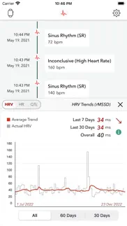 ecg+ | analyzer for qtc & hrv iphone screenshot 2