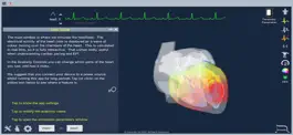 Game screenshot Epicardio Heart Simulator apk