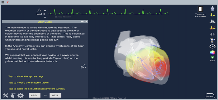 Epicardio Heart Simulator