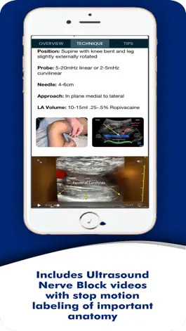 Game screenshot PNBschool Anesthesia Blocks apk