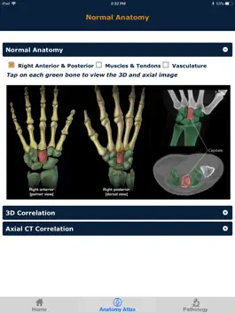 Game screenshot CTisus: CT of the Hand & Wrist apk