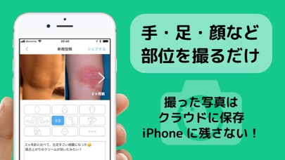 アトピー見える化アプリ-アトピヨ screenshot1