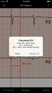 ep calipers iphone screenshot 4