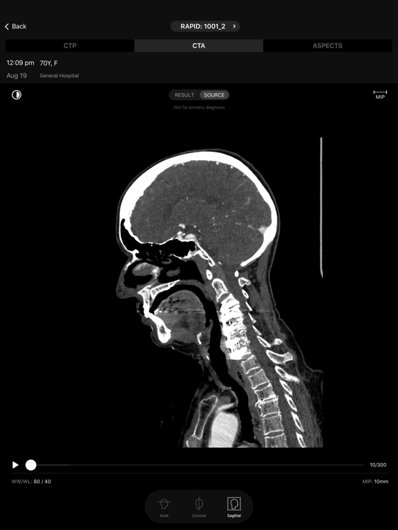RapidAI iPad screenshot 4 - Medical app