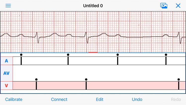 EP Diagram