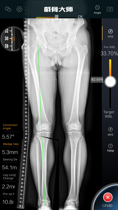 Screenshot #2 pour 截骨大师