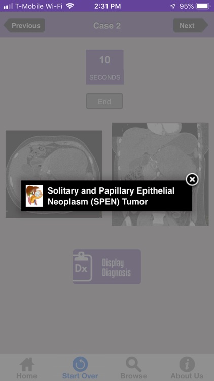 CTisus Challenge: The Pancreas