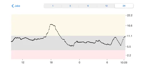 Dexcom Follow mmol/L DXCM1