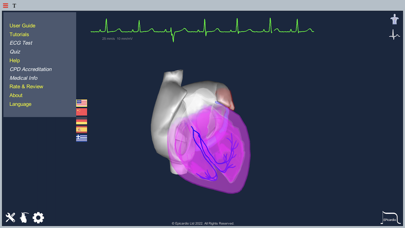 Epicardio Heart Simulatorのおすすめ画像8