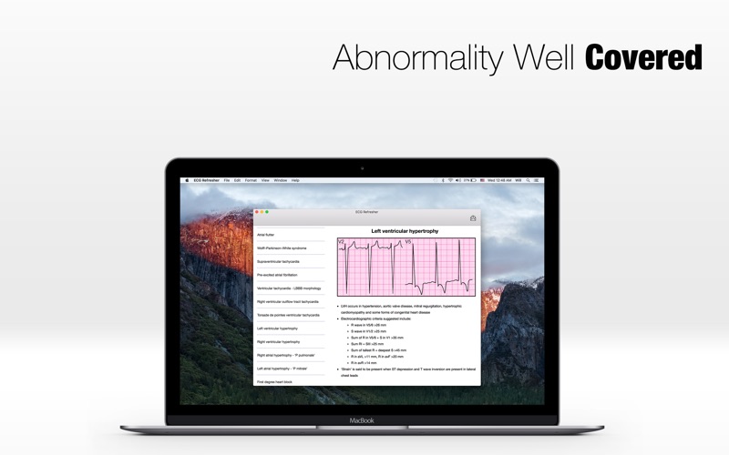 Screenshot #1 pour ECG Refresher