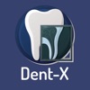 Dent-X