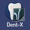 Dent-X