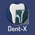 Dent-X App Contact