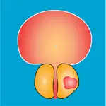 Nyushko prostate nomograms App Support