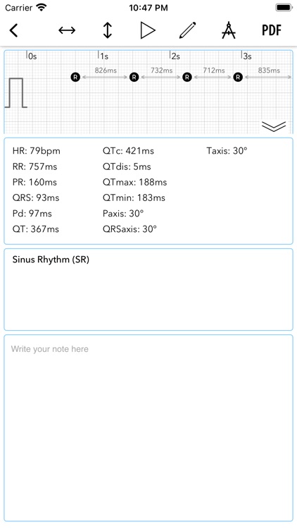 ECG+ | Analyzer for QTc & HRV screenshot-5