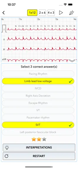 Game screenshot ECG Test Pro for Doctors mod apk