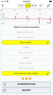 ecg test for doctors iphone screenshot 4
