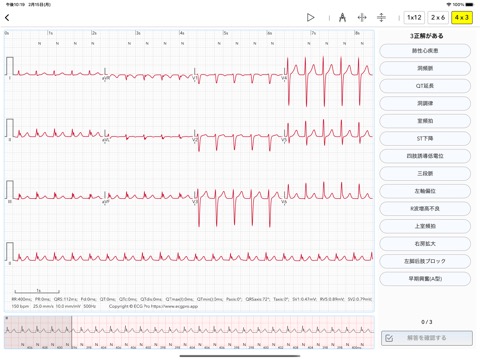 ECG Test Proのおすすめ画像10