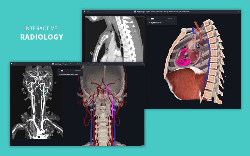 Complete Anatomy 24 screenshot1