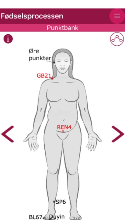 AcuBirth - v. Siegumfeldt