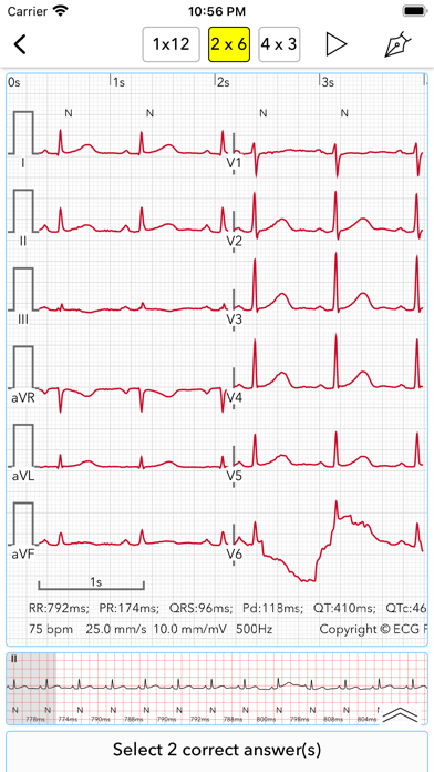 ECG Test for Doctors screenshot 3