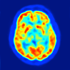 Neurosurgery: What's the data? - Limbix LLC