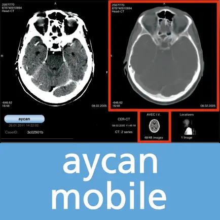 aycan mobile USA Cheats