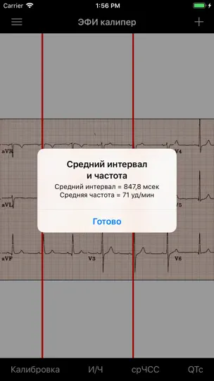 Скриншот ЭФИ калипер на iPhone 7