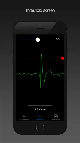 Game screenshot Spike Recorder mod apk