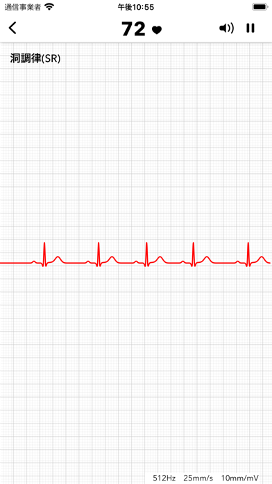 ECG+スクリーンショット