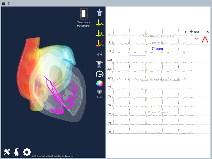 Epicardio Heart Simulator