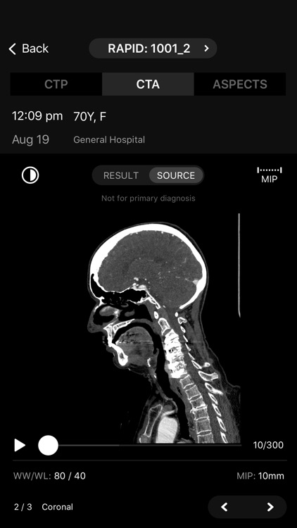 RapidAI screenshot-3