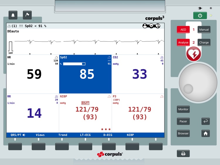 corpuls simulation screenshot-4