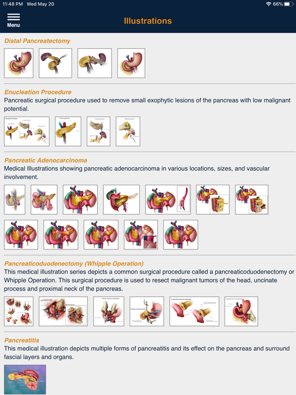 CTisus Pancreas Compendiumのおすすめ画像2