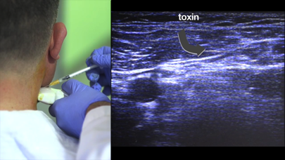 iToxin Screenshot