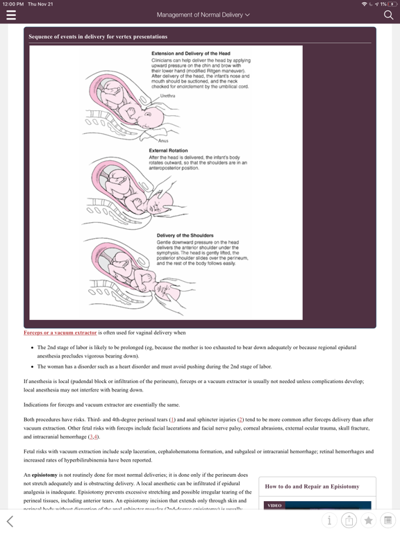 MSD Manual Guide to Obstetrics iPad screenshot 4 - Medical app