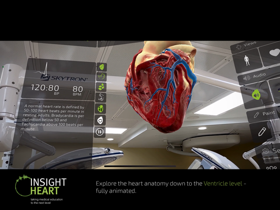 INSIGHT HEART iPad app afbeelding 7